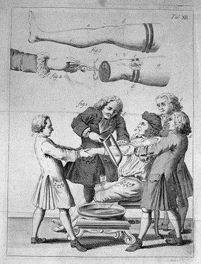 The elements of surgery ... Adapted to the use of the camp and navy, as well as of the domestic surgeon ... / [Samuel Mihles].