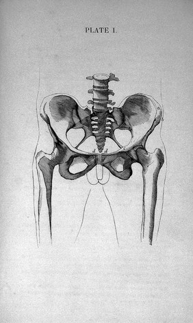 A treatise on hernia, explaining its varieties, situation, symptoms, and causes : to which is added a full description of the construction and application of the most approved mechanical remedies / By G.S. Acret, truss maker, 39, Houndsditch.