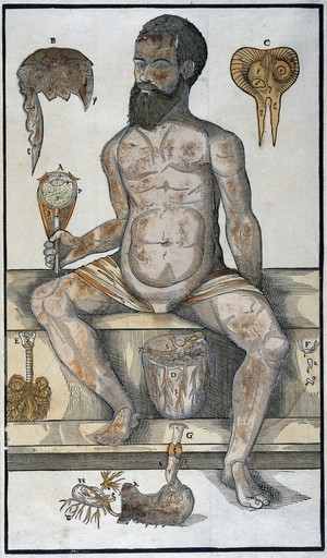 view Anatomical fugitive sheet, male