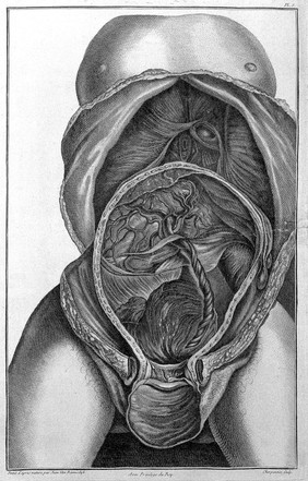 Demonstration de la matrice d'une femme grosse et de son enfant a terme. Ouvrage en six planches peintes d'après nature et disposées de façon à donner l'idée la plus exacte de l'état de grossesse / Par les soins et sous la direction, de Charles Nicolas Jenty.