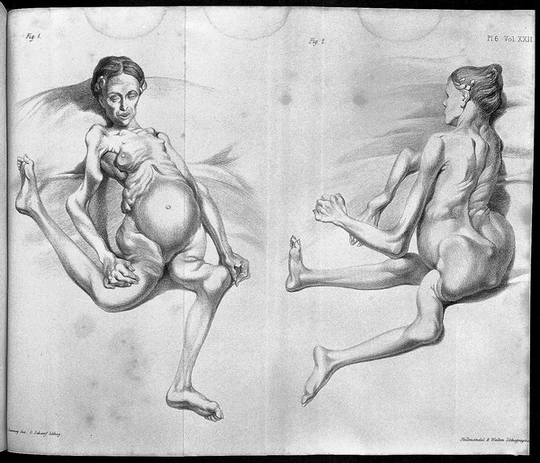 Medico-chirurgical transactions.