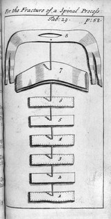 A description of bandages and dressings, according to the most commodious ways now used in France / Written in French ... Translated into English [from 'L'appareil commode'].