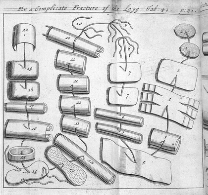 A description of bandages and dressings, according to the most commodious ways now used in France / Written in French ... Translated into English [from 'L'appareil commode'].