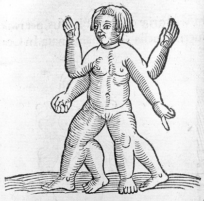 Prodigiorum ac ostentorum chronicon, : quae praeter naturae ordinem, motum, et operationem, et in superioribus & his inferioribus mundi regionibus, ... / per Conradum Lycosthenem.