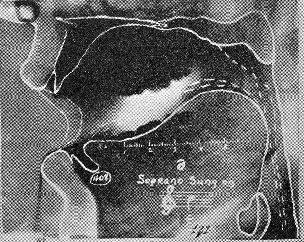 Speech and voice : with X-rays of English, French, German, Italian, Spanish, soprano, tenor, and baritone subjects / by G. Oscar Russell.