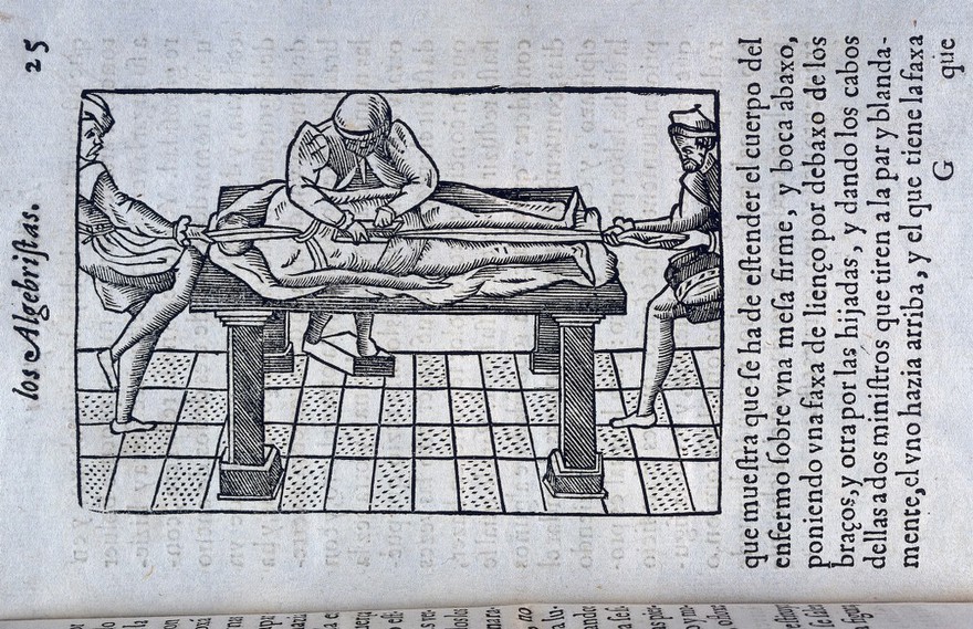 Instituciones que Su Magestad mando hazer al doctor Mercado ... para el aprovechamiento y examen de los algebristas. En las quales se declaran las diferencias que ay de conyunturas, y los modos que puede aver de desconcertarse. Assi mismo, como se pueden y deven reduzir a su figura y lugar. Y ultimamente se trata de los huessos quebrados y de su curacion / [Luis Mercado].