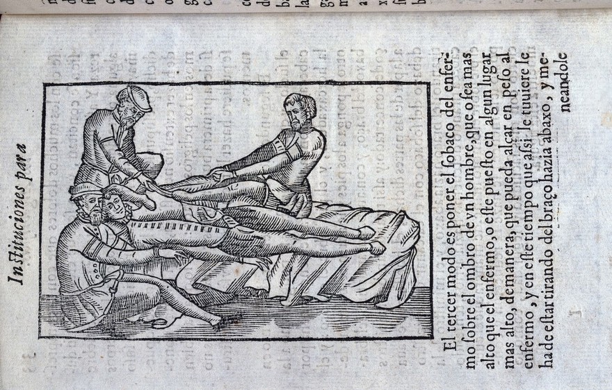 Instituciones que Su Magestad mando hazer al doctor Mercado ... para el aprovechamiento y examen de los algebristas. En las quales se declaran las diferencias que ay de conyunturas, y los modos que puede aver de desconcertarse. Assi mismo, como se pueden y deven reduzir a su figura y lugar. Y ultimamente se trata de los huessos quebrados y de su curacion / [Luis Mercado].