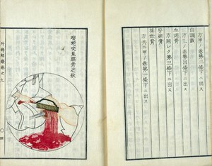 view Gendai, geka kihai, dictated to his pupil Matsuoka Hajime. Treatise on internal medicine spread from book 9.