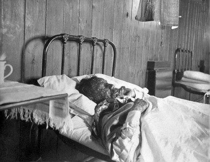 A nurse and a smallpox patient in an isolation hospital, possibly at Ilford, Essex. Three photographs.