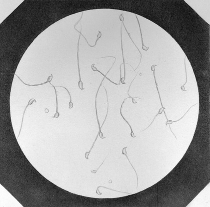 Cours de microscopie complémentaire des études médicales ... / par Al. Donné.