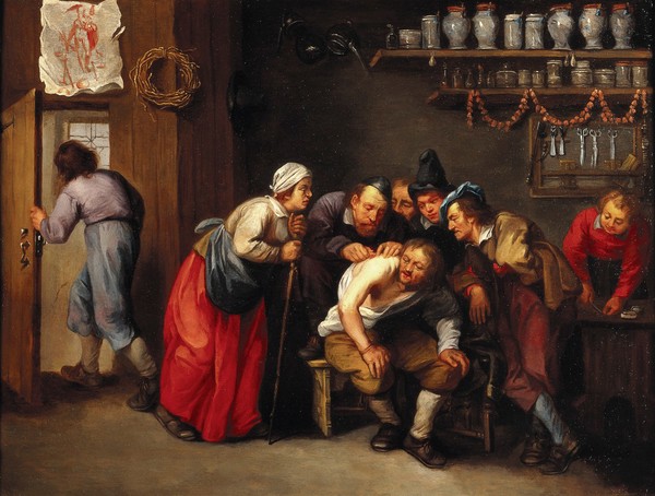 A surgeon removing a plaster from a man's back, with five people looking on. Oil painting attributed to Adriaen Rombouts, 16--.