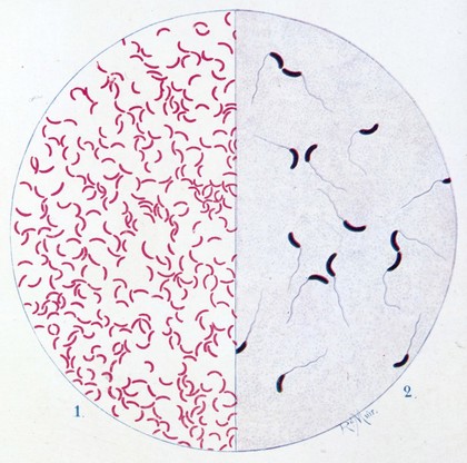 Bacteriological atlas : a series of coloured plates illustrating the morphological characters of pathogenic micro-organisms / by Richard Muir.