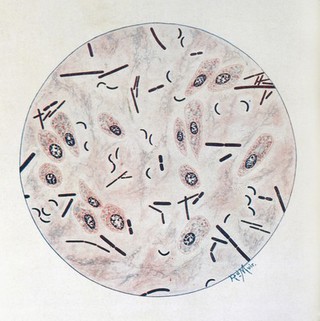 Bacteriological atlas : a series of coloured plates illustrating the morphological characters of pathogenic micro-organisms / by Richard Muir.