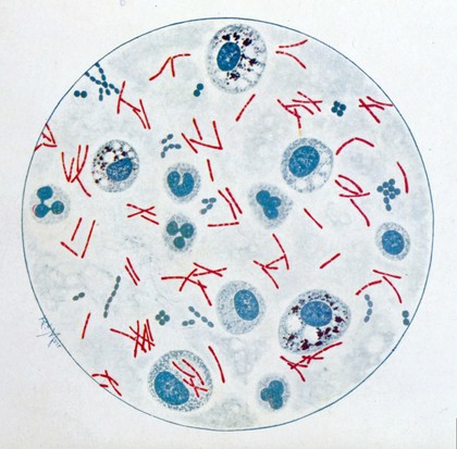 Bacteriological atlas : a series of coloured plates illustrating the morphological characters of pathogenic micro-organisms / by Richard Muir.