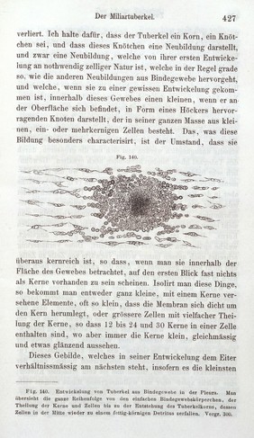 Die Cellularpathologie : in ihrer Begründung auf physiologische und pathologische Gewebelehre zwanzig Vorlesungen gehalten während der Monate Februar, März und April 1858 im pathologischen Institute zu Berlin / von Rudolf Virchow.