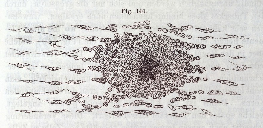 Die Cellularpathologie : in ihrer Begründung auf physiologische und pathologische Gewebelehre zwanzig Vorlesungen gehalten während der Monate Februar, März und April 1858 im pathologischen Institute zu Berlin / von Rudolf Virchow.