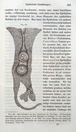 Die Cellularpathologie : in ihrer Begründung auf physiologische und pathologische Gewebelehre zwanzig Vorlesungen gehalten während der Monate Februar, März und April 1858 im pathologischen Institute zu Berlin / von Rudolf Virchow.