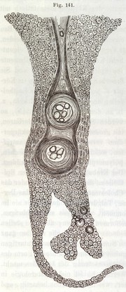 Die Cellularpathologie : in ihrer Begründung auf physiologische und pathologische Gewebelehre zwanzig Vorlesungen gehalten während der Monate Februar, März und April 1858 im pathologischen Institute zu Berlin / von Rudolf Virchow.