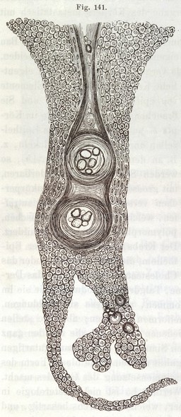 Die Cellularpathologie : in ihrer Begründung auf physiologische und pathologische Gewebelehre zwanzig Vorlesungen gehalten während der Monate Februar, März und April 1858 im pathologischen Institute zu Berlin / von Rudolf Virchow.