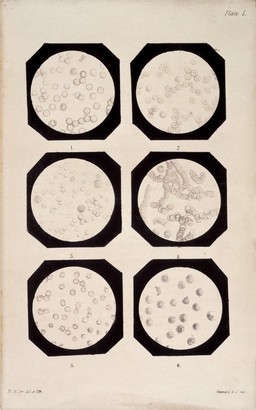 The microscopic anatomy of the human body in health and disease / By Arthur Hill Hassall.