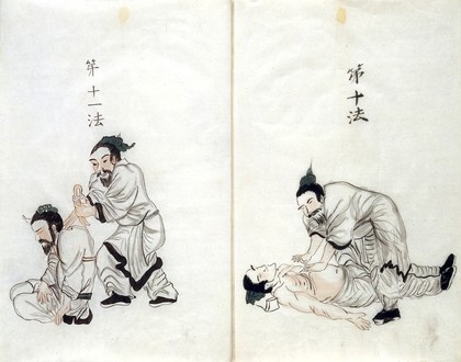 (left) A man who has hanged himself, (right) a man who has drowned being reuscitated. A manuscript with details describing techniques to resuscitating people who have drowned, hung themeselves, collapsed or lost consciousness.