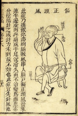 view Fu Jen-yu, Compendium of Ophthalmology, 1644