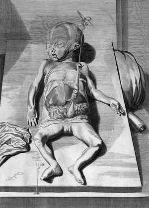 view W. Cowper, Anatomy of Humane Bodies, 1698