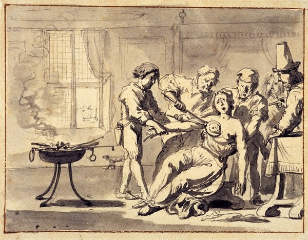 Mastectomy. Drawing attributed to a Dutch artist, 17th century.