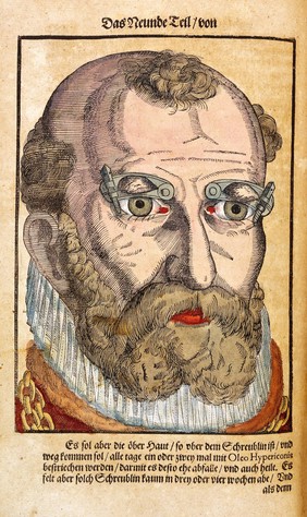 Bartisch, Ophthalmodouleia, 1583