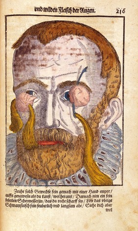 Bartisch, Ophthalmodouleia, 1583