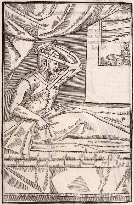 Gasparo Tagliacozzi, De curtorum chirurgia p