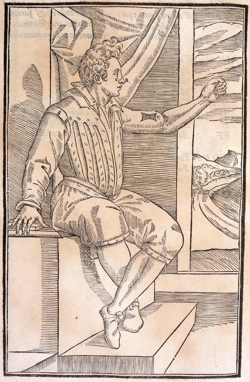 Gasparo Tagliacozzi, De curtorum chirurgia p