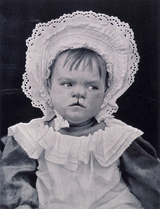 K.Pearson, ed., Treasury of Human Inheritanc