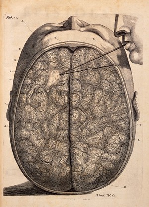 view F. Ruysch, Epistola anatomica, problematica