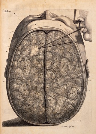 F. Ruysch, Epistola anatomica, problematica