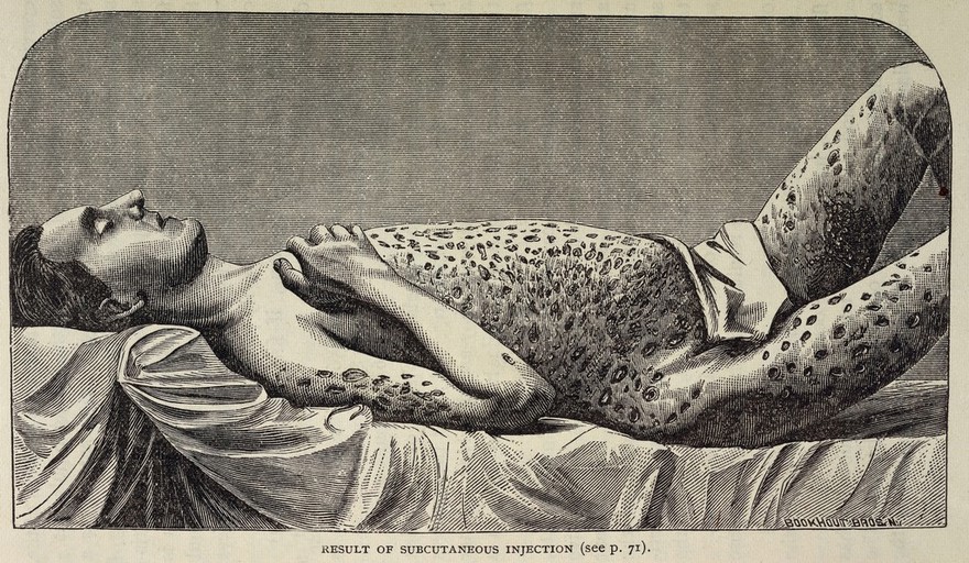 Drugs that enslave : the opium, morphine, chloral and hashisch habits / by H.H. Kane.
