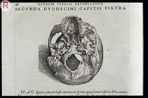 view VESALIUS: De Humani Corporis Fabrica