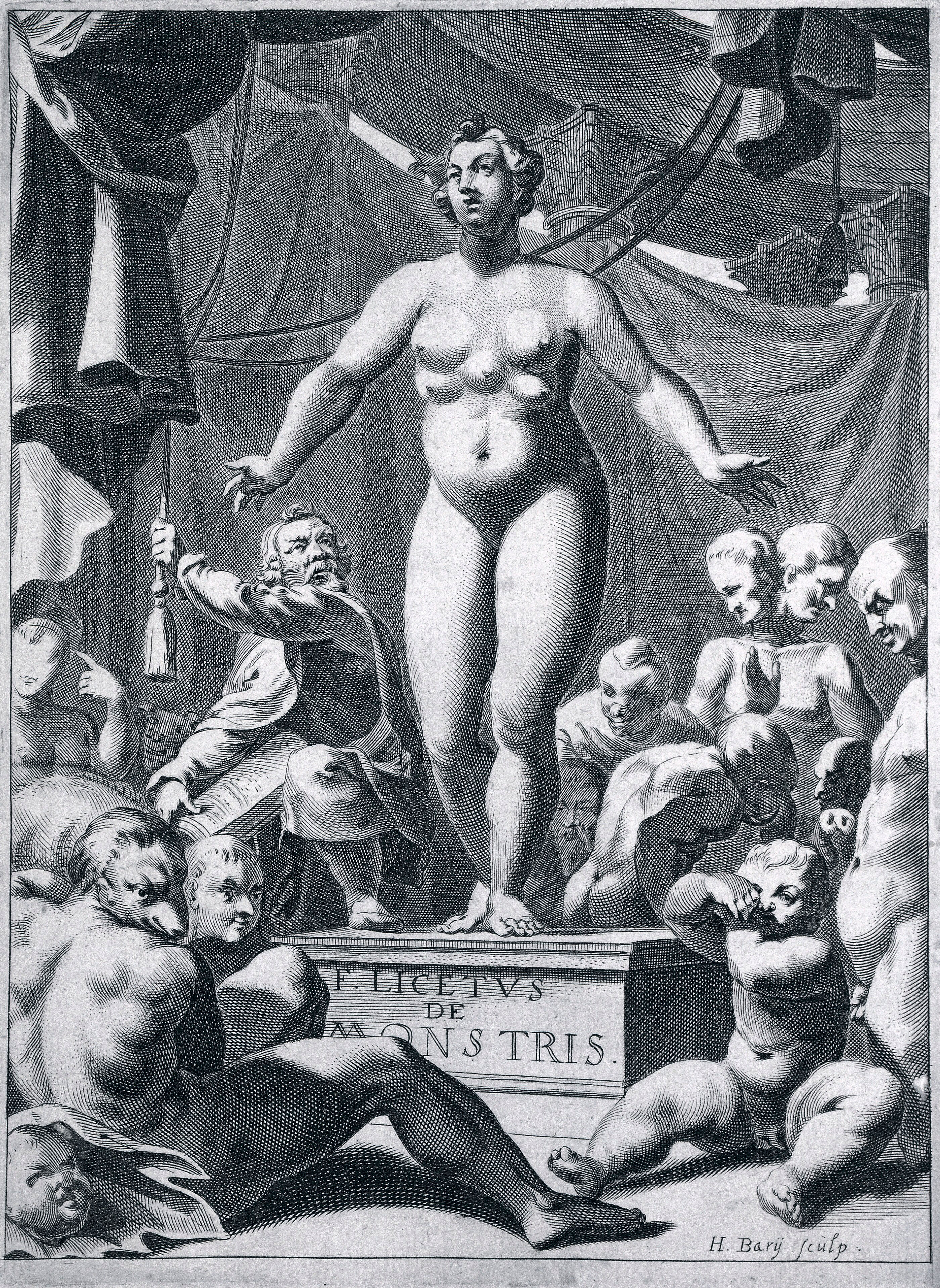Woman with multiple breasts | Wellcome Collection