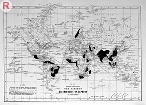 view Distribution of leprosy around the world