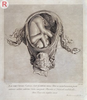 W. Hunter, Anatomia uteri humani gravidi tab