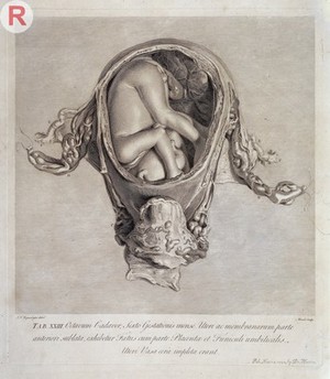 view W. Hunter, Anatomia uteri humani gravidi tab