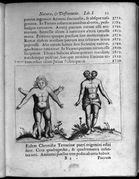 Two human figures with abnormalities, one with two sets of arms and legs and the other with two heads