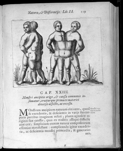 Two human figures with abnormalities