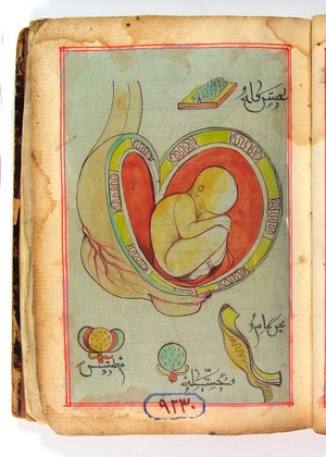 view Figure of a baby in a womb. Turkish Ottoman Manuscript