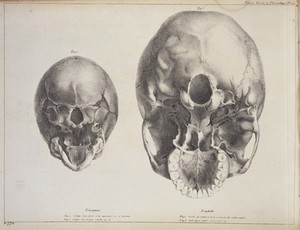 view Skull of child at birth and woman