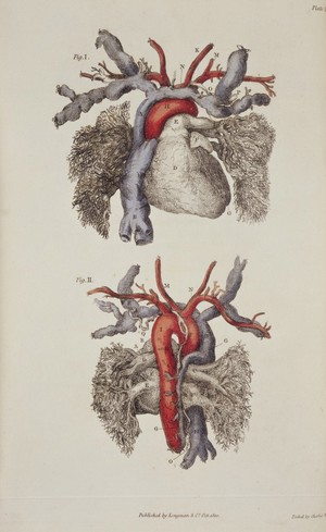 view Front and back view of the heart