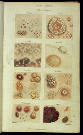 'Eight orders of cutaneous diseases': 