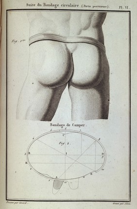 Diagram of a Hernia bandage on male subject