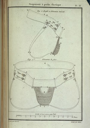 view Diagram of a corset for the treatment of masturbation. Suspensoir a poche elastique. (Suspending rod has pocket elastic) Fig. 1. Elevation de face, et tel qu'il doit etre place et vu sur le sujet. (Elevation in face, and such as it must be placed and seen on the subject) Fig. 2. Elevation lateralr, ou profil (Elevation lateral, or profile)