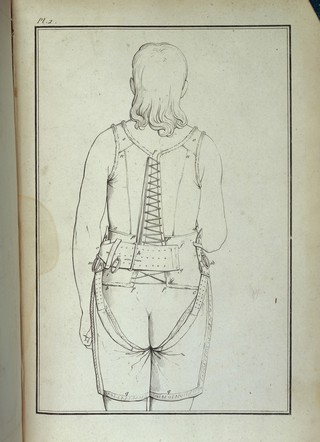 Woman wearing appliance for treatment against masturbation.